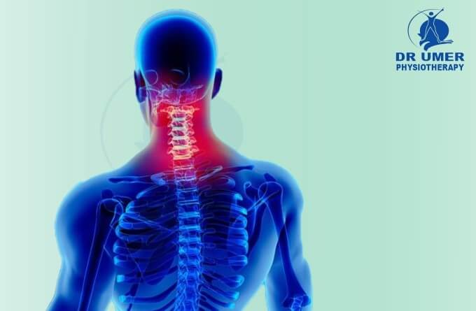 Physiotherapy for Cervical Pain