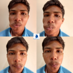 Rotate the tip of the tongue