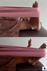 Foot Drop - Physiotherapy for Foot Drop