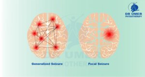 What is Epilepsy? What is Epilepsy?
