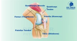 Physiotherapy for Knee Pain