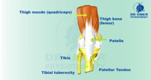 Osgood-Schlatter Disease  