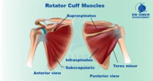 Physiotherapy in Rotator Cuff Injury Physiotherapy in Rotator Cuff Injury